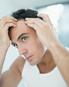 Male Hair Loss Treatment Roseville