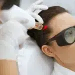 How Long Does Laser Hair Therapy Take to Show Results?